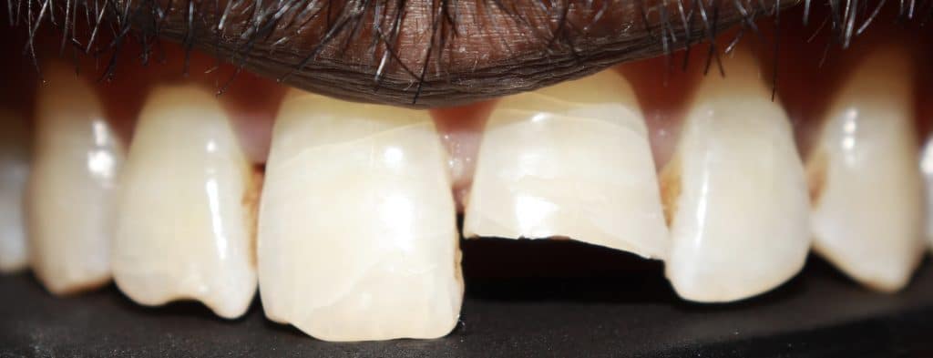 5E899F56-9DE0-4EC4-822B-30B4A4BE6D8F