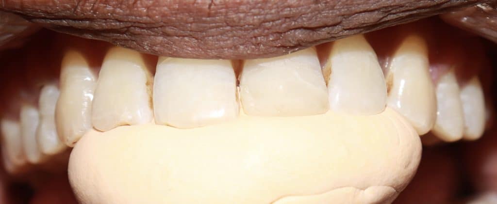 F29BBCD0-99B9-4F2A-ADAE-1CAA8C702AC8