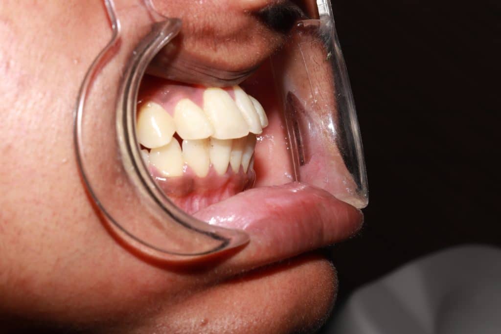 9E94D1E6-3ED8-4155-8877-5C3E2403398F