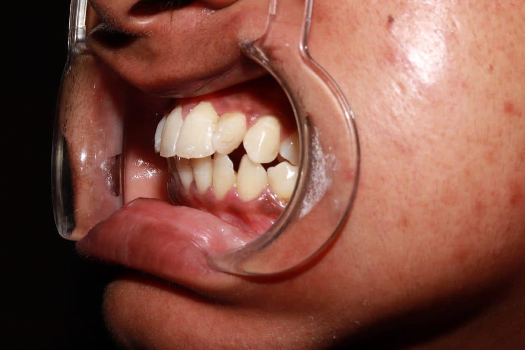 AE4A01D8-E337-414D-A0C0-610BCB1C19E8