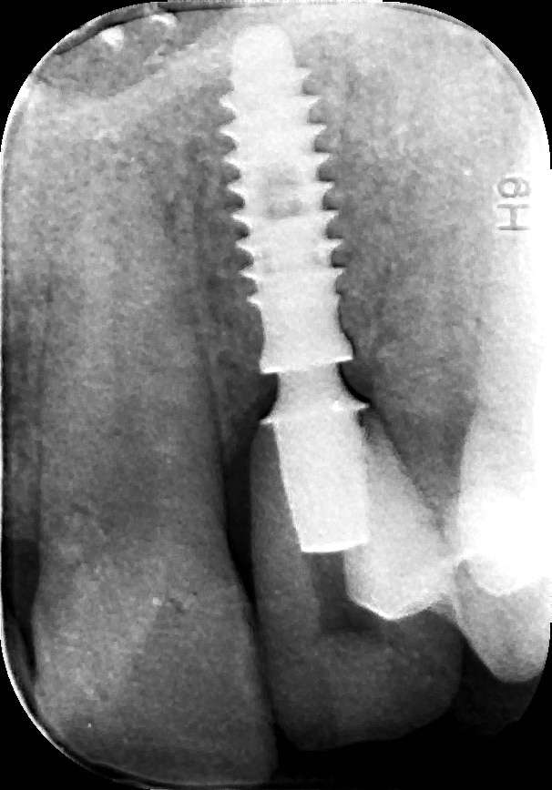 15 rx ctr 11-10-18 (1)