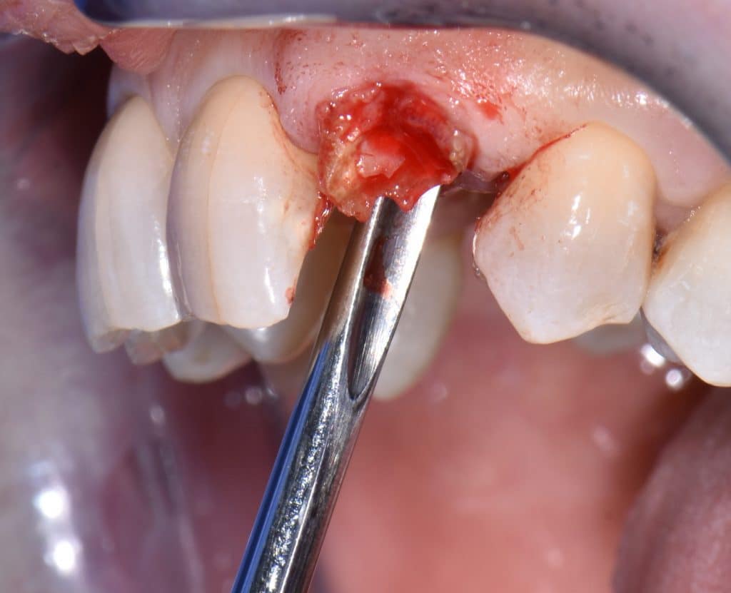 2 foto estrazione (4)