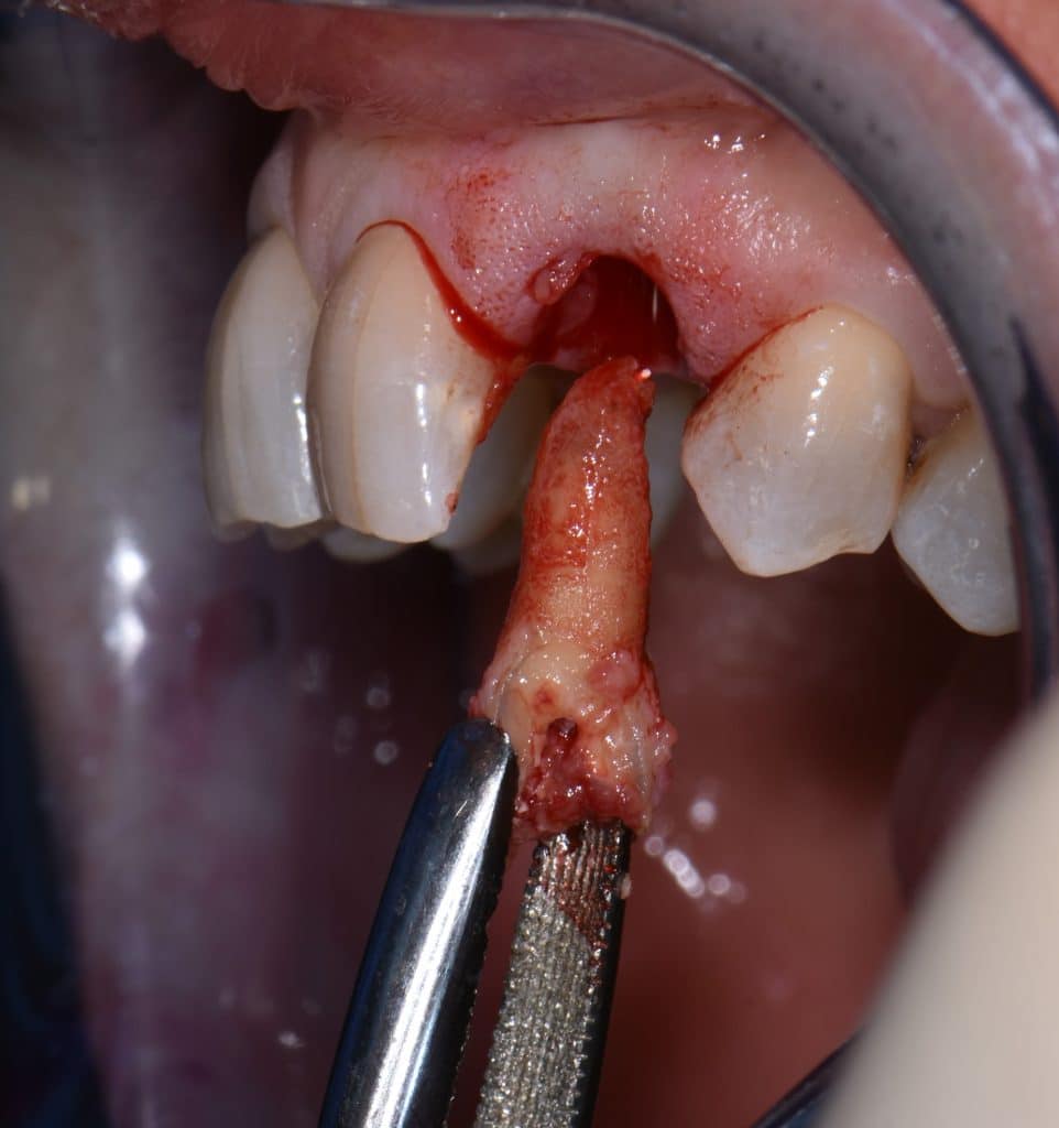 2 foto estrazione (5)