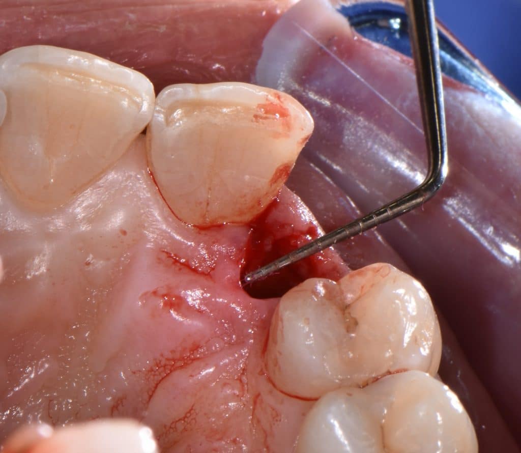 2 foto estrazione (7)