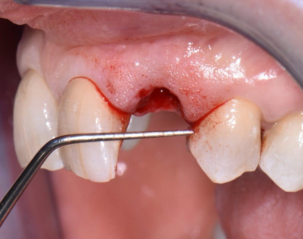 2 foto estrazione (8)