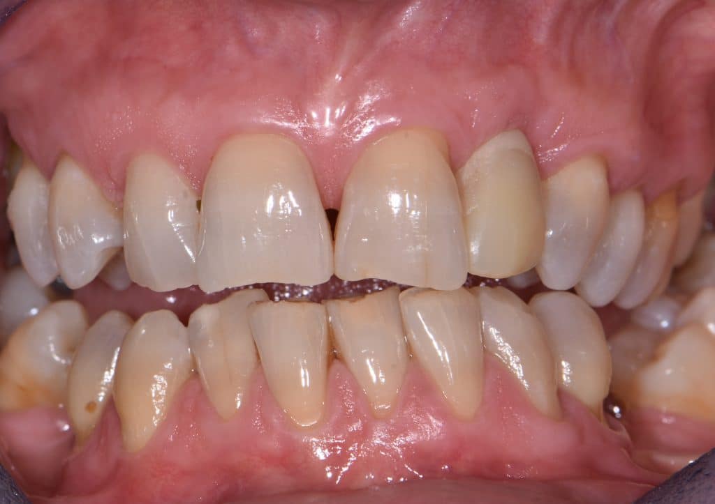 9 guarigione su prossisorio (2)