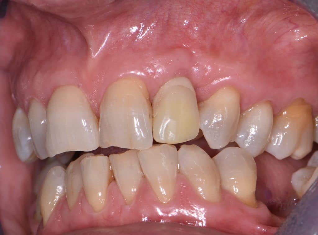 9 guarigione su prossisorio (3)