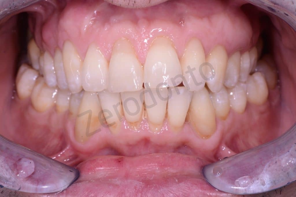 08714EA6-FB43-45A9-8133-C4BB248D3B4D_1_105_c