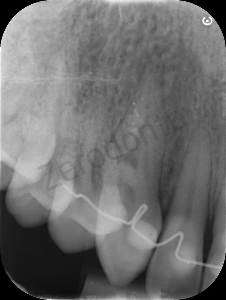 1CD5893B-D92F-4A83-AEC9-2D65924B9A1E_1_105_c