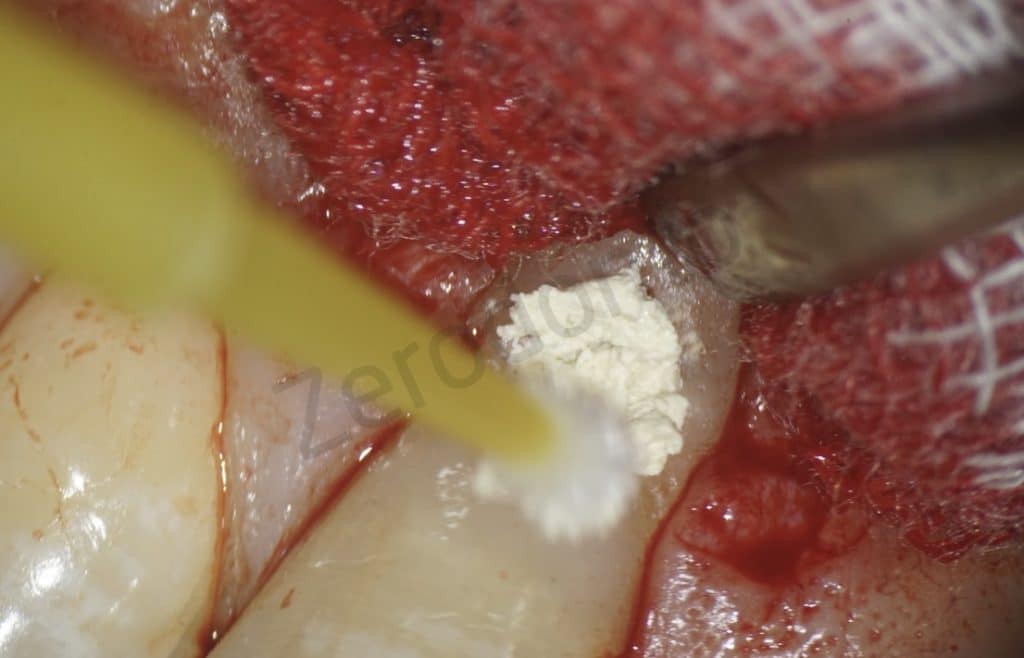 A23C4241-62E3-4EF1-A040-20104FA51084_1_105_c