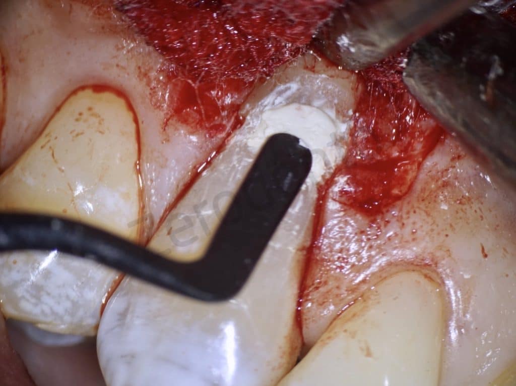 BE6DBB2F-DA3F-43ED-827B-3C13AD380466_1_105_c