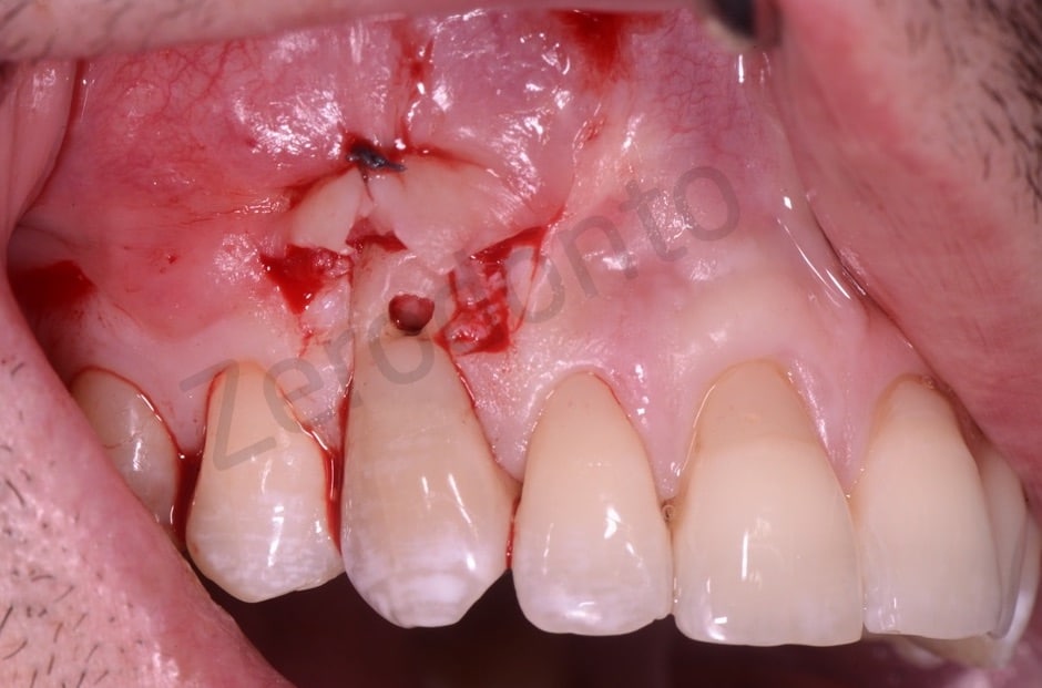 C67176EE-B59B-4FF8-AA31-92F66CCA2BF0_1_105_c