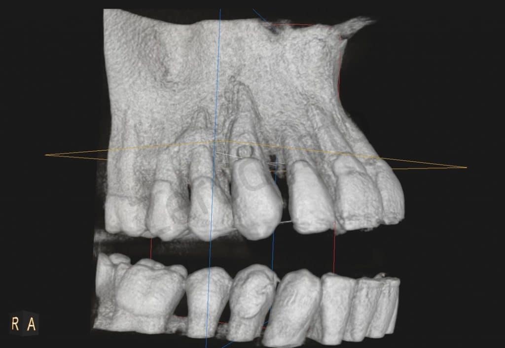 D87D81C3-4F75-460C-98B2-33CF5D9C04E9_1_105_c