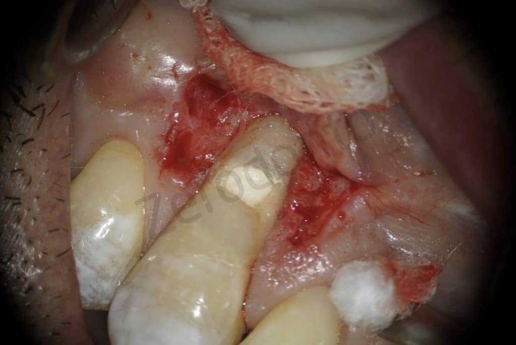 FCF8F934-0C2D-448A-9538-49AF51C0DE09_1_105_c