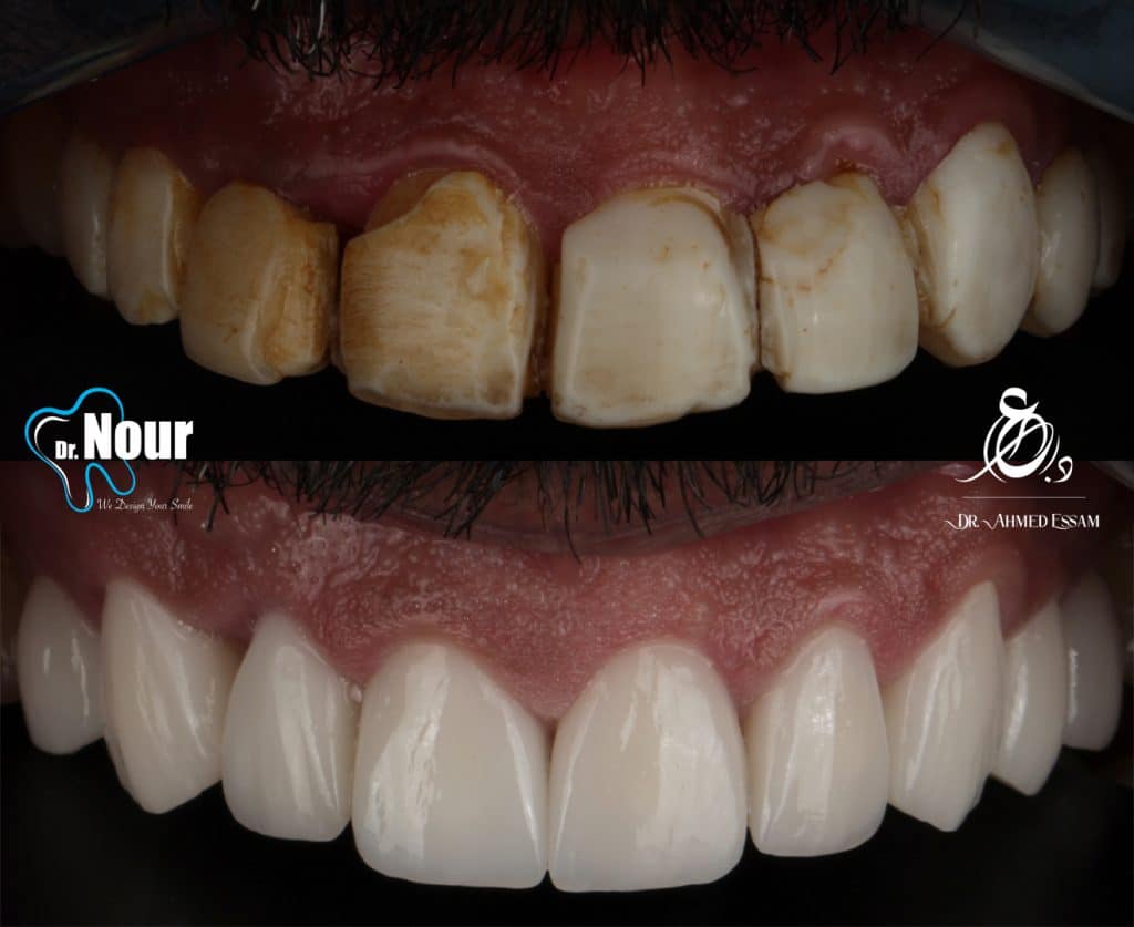 0BDAE292-2F33-48E8-8E87-14B8157EDBAE