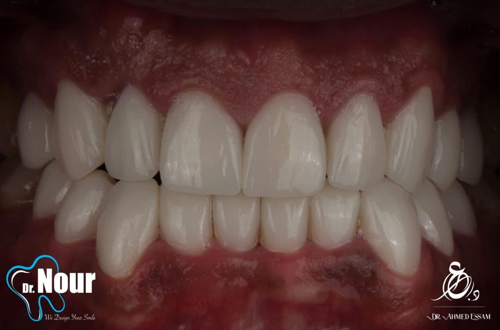 8BE1AD1B-78F6-41CC-B36A-AFF209F9AB64