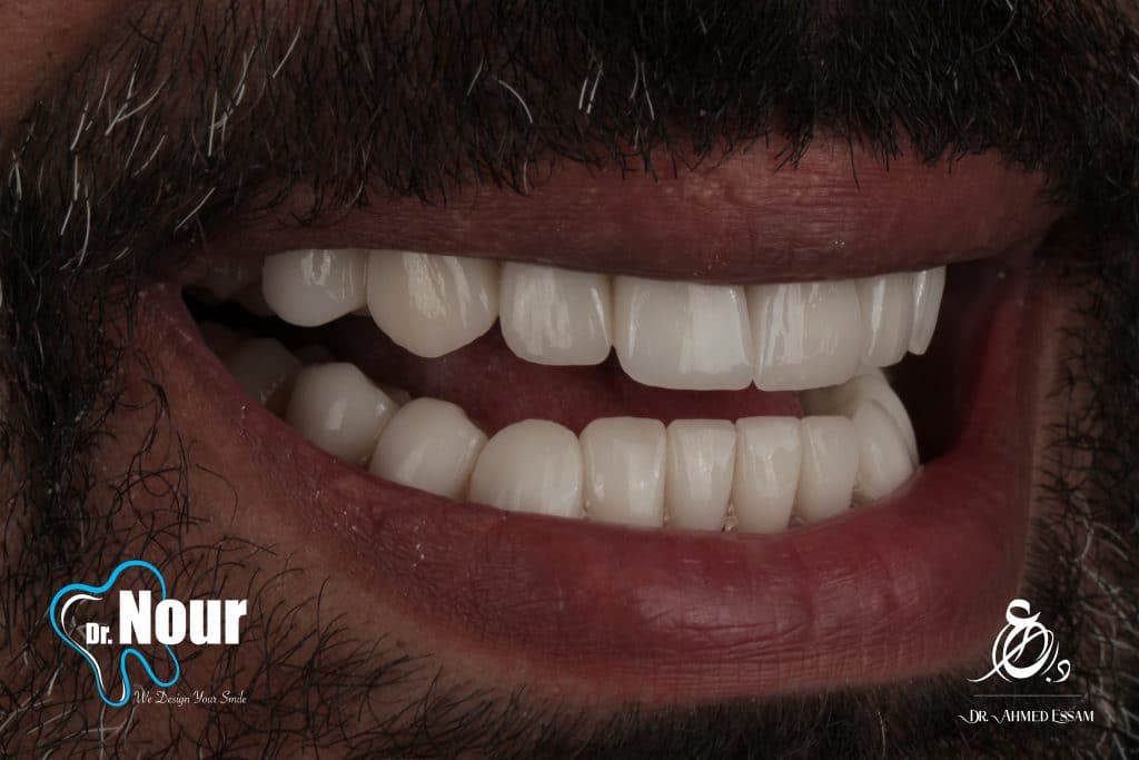 CFC7D253-8833-42AD-86D1-2F265BB63B58