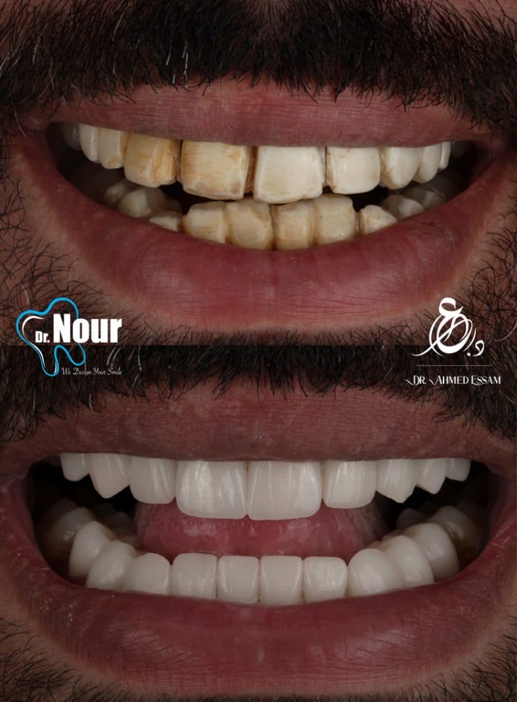 D85D9F32-B57B-4B3A-933B-E6C4530EF91C