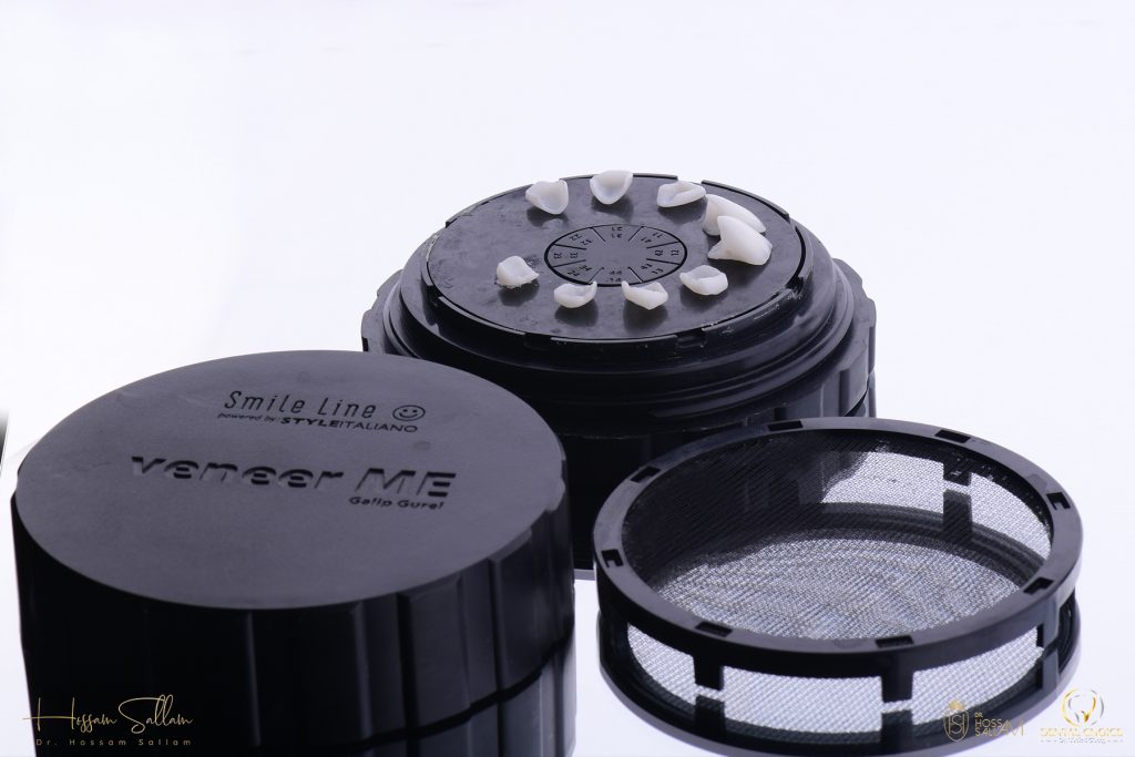 Fig.11 Emax preparing