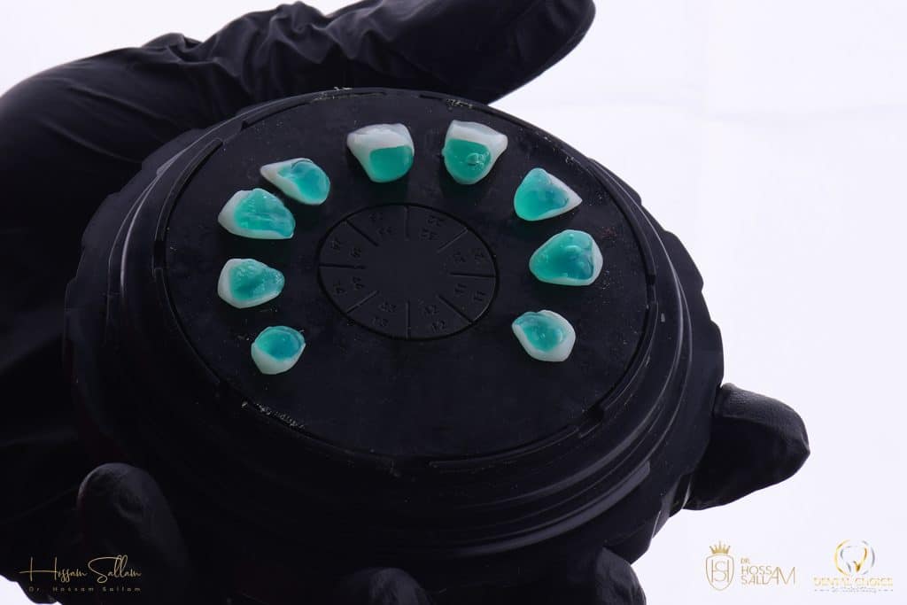 Fig.12 Lithium Disilicate etching