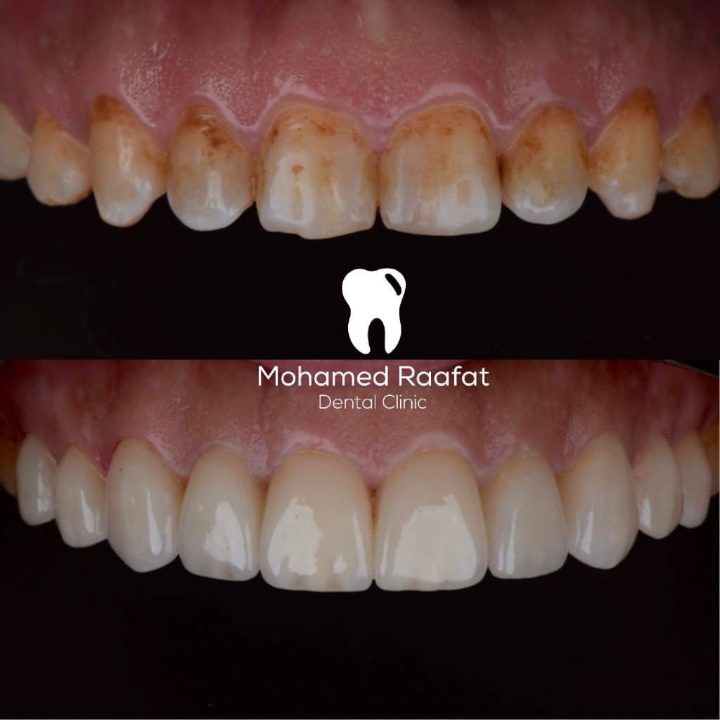 0101139C-9E0C-4A4B-8024-1FD44F242541