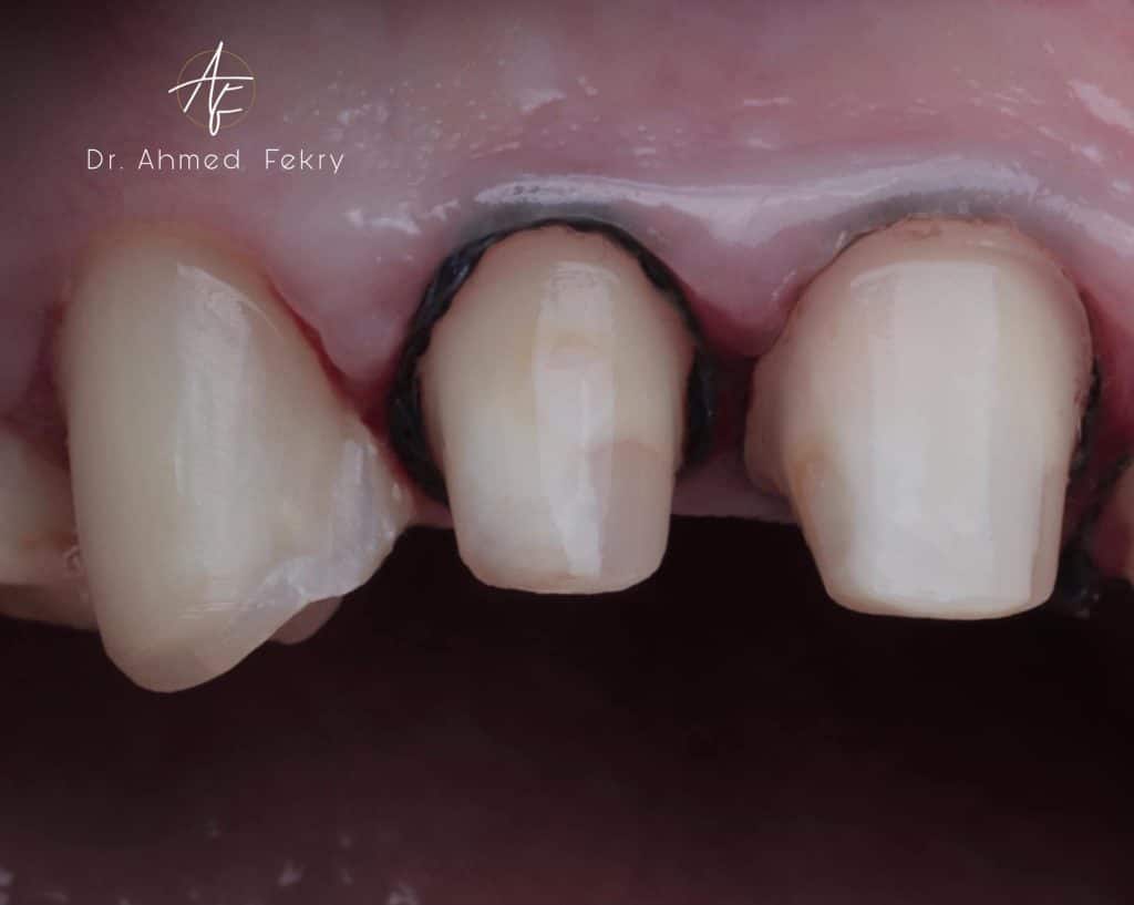 0679699C-A6CE-466E-B1A5-9A124AA644DD