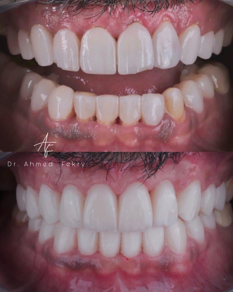 08DC9AC4-04E4-4210-ABE0-E014DF9018A3