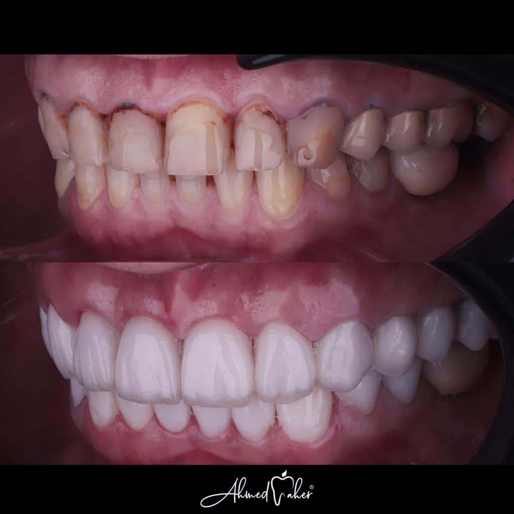 0EE55512-EF3C-483A-980C-F2B03EFBB885