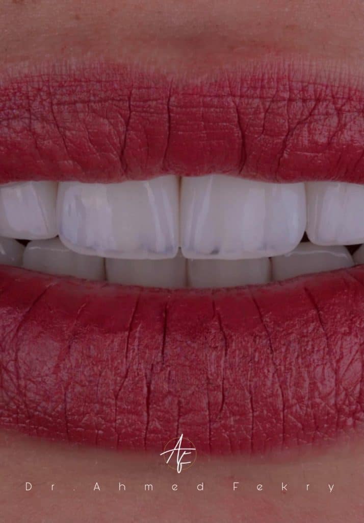 10FD04CC-352A-45AC-8FD4-92D03D0C037D