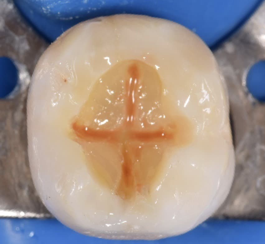 122A9BE7-3701-4489-B418-C210ECF5EE5A