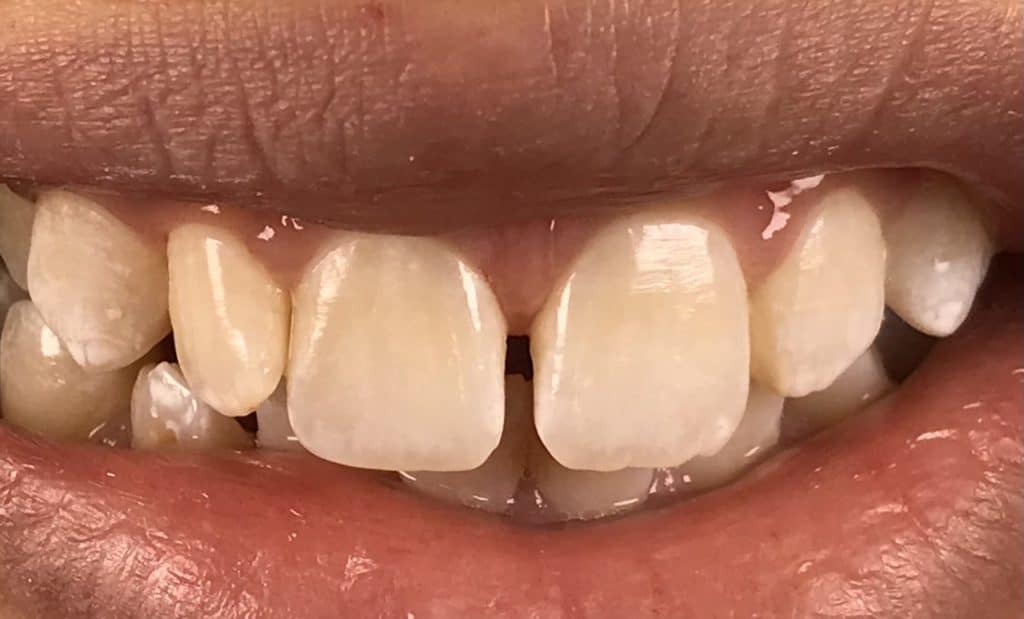 1A9334B1-77EC-4666-AF69-DE30E7621171