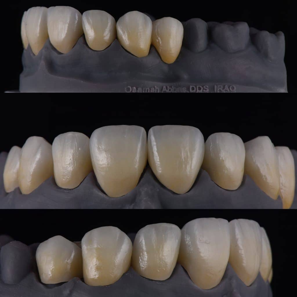 1B70EDA0-D323-47D3-AC65-C96D21E7CC40