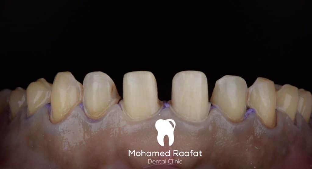 1F66660B-642B-48B0-A20B-8682BD74A0C4