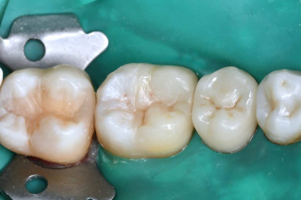 2F0D043B-8DBF-4B27-8926-EFCCD10A84BD