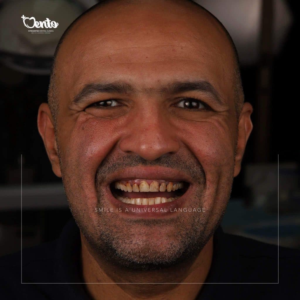 37F2512C-BFFF-45E7-BFE3-3197B09D1251