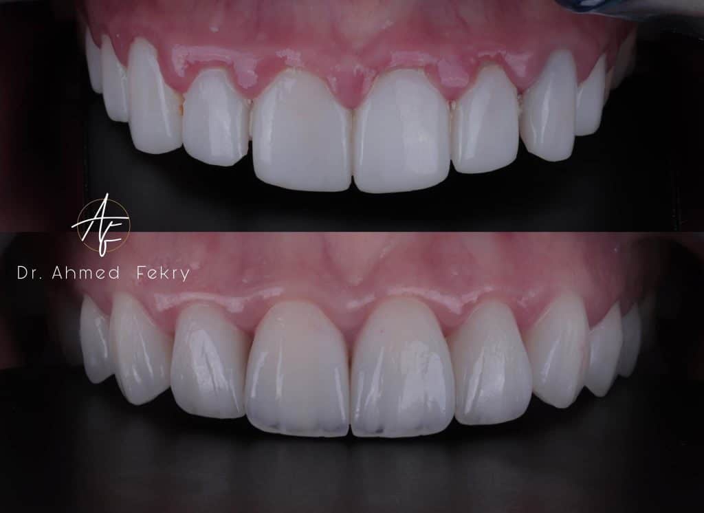 3EE60F33-19C0-4542-86F9-47C5862DD42F