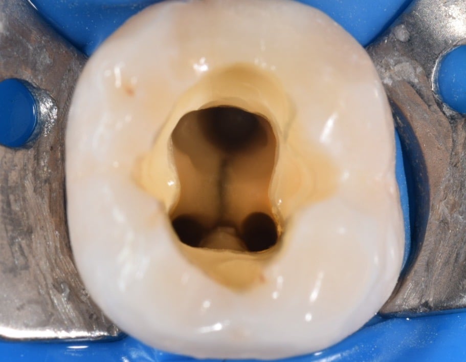 5313321D-67F8-419C-894A-FA1237309B68