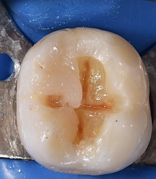 57F20B5B-00C3-4331-8D0B-C093713DAA66