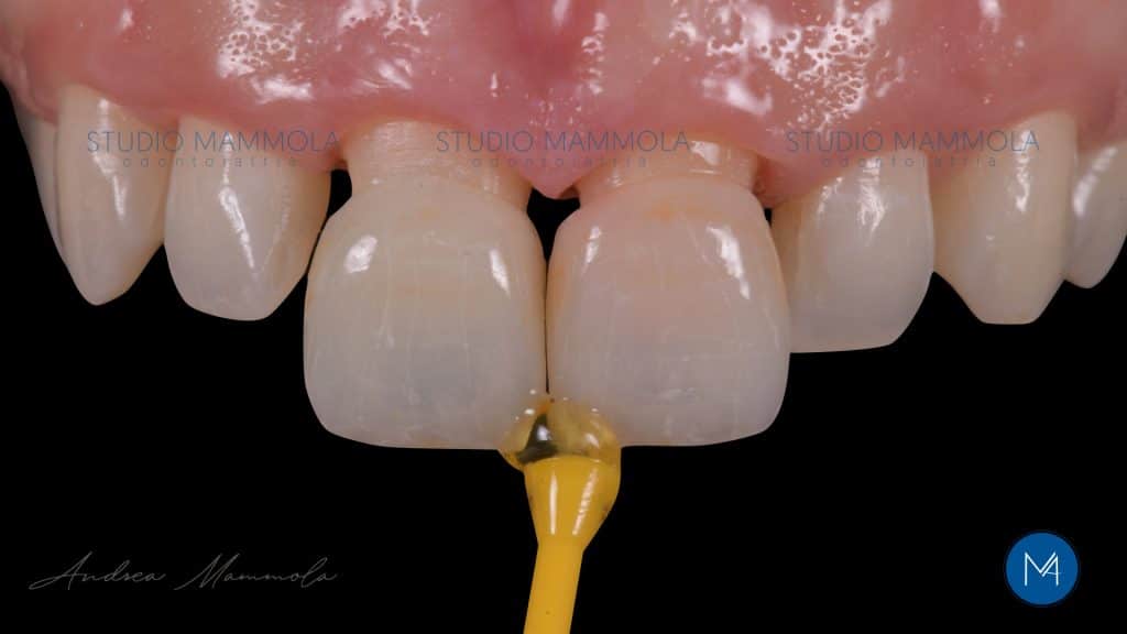 5E208126-883C-43C7-B4CA-161ADB1F981F