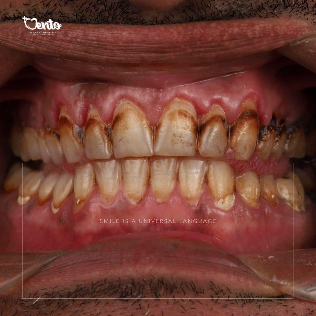 61F3CF6F-35BC-4087-86D6-27F45A71C5B0