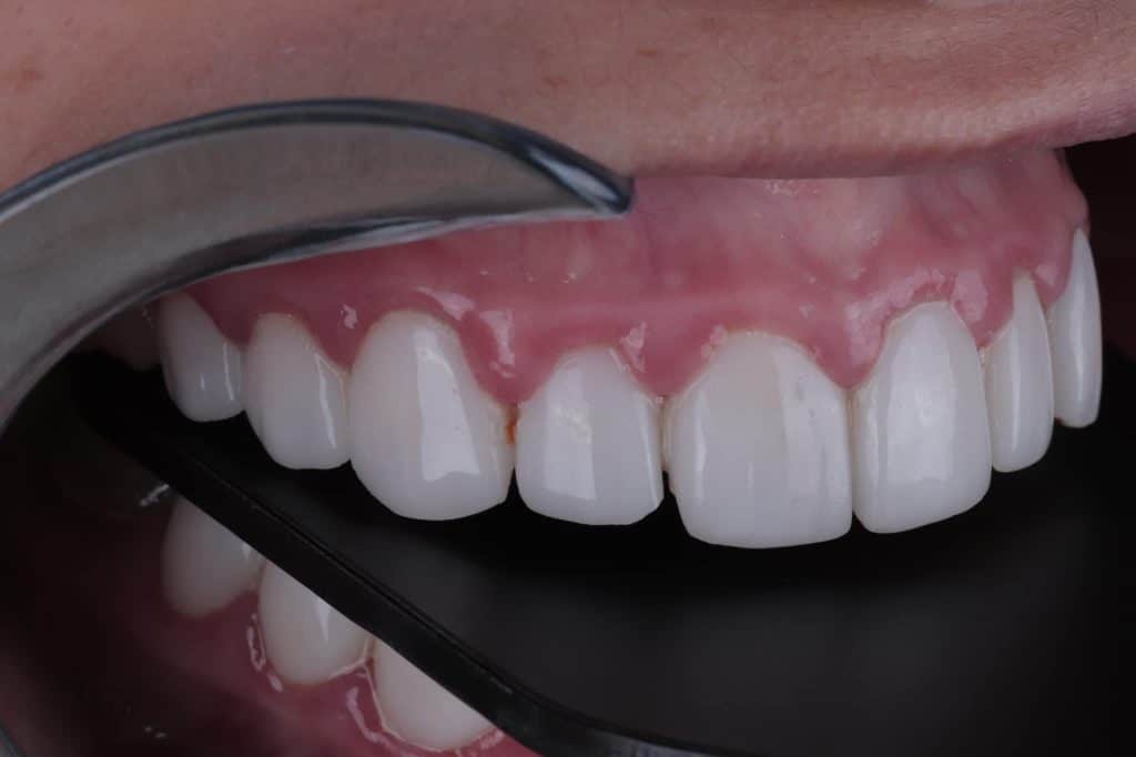 7815AF53-CF04-4C39-996E-03A898FC5AC5