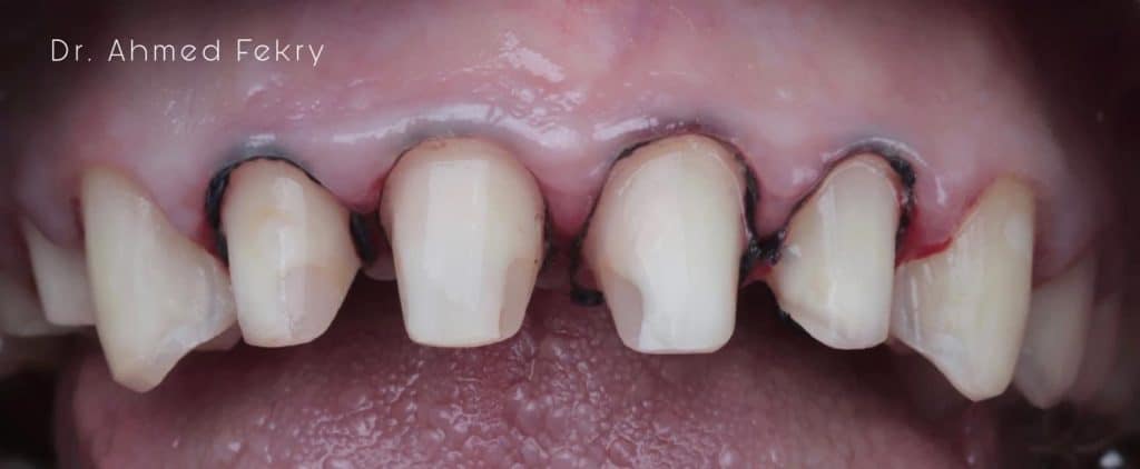 85AC43D7-AB3D-4A3A-B9E0-10061EAA9C6C