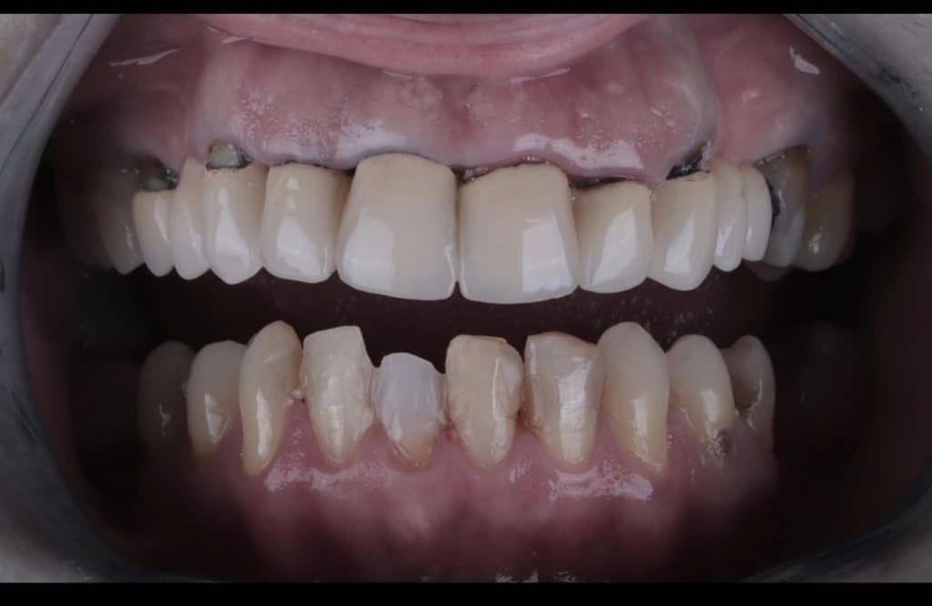 97D7DD78-ABBB-4D75-93AE-14F4A3D8430E