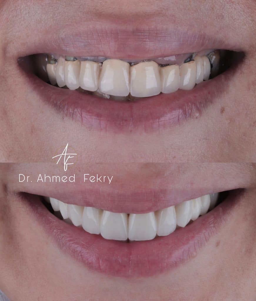 A3287148-FB85-43B1-9EF8-0CEB303701E8