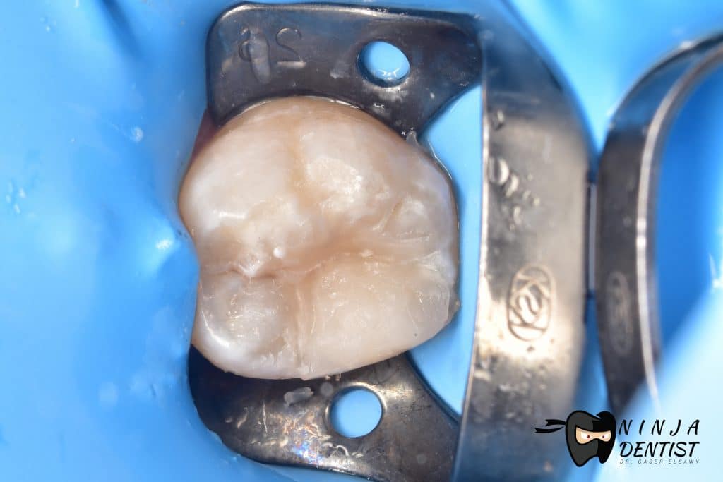 A7EDD1A6-7407-449D-8F33-9BD1C821F8DB