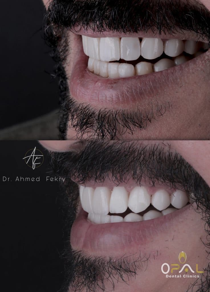 A83B7F89-F3BB-4E66-A4AC-20F66BB65EE4