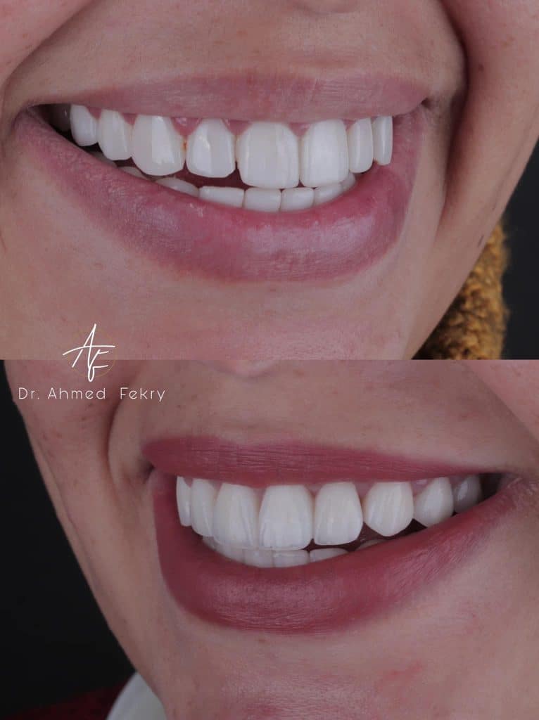 A88677E1-F54A-4CCD-B2FB-DF49325AB4EF