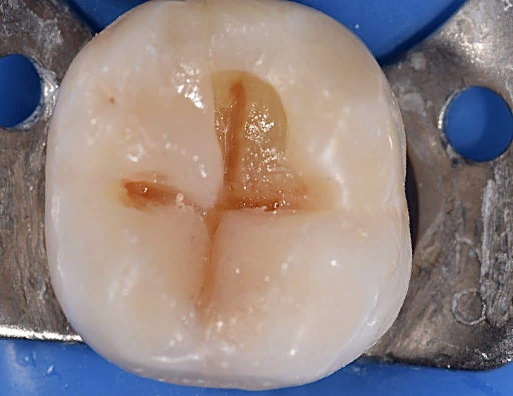 A89E739A-C356-4C87-A105-B22B5271619B