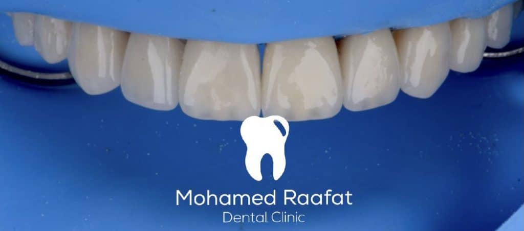 AE880285-CE79-446D-985D-FC22AEDFA859