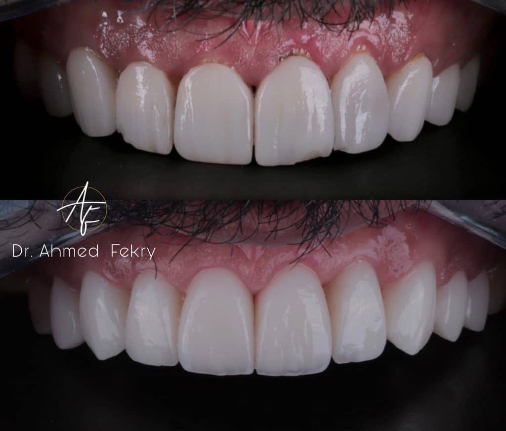 BFD3817B-EF6D-4791-88D6-37F3705F1E5F